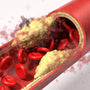 Does High Flavanol Cacao Remove Arterial Plaque? Does High Flavanol Cacao Really Work? - Vital Purple